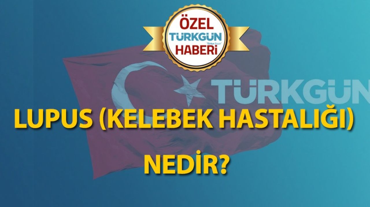 Lupus (Kelebek hastalığı) nedir?