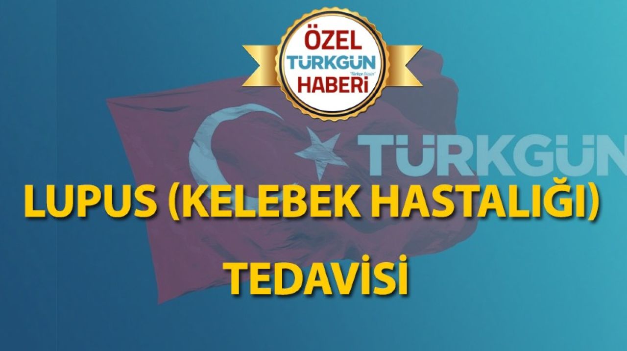 Lupus (Kelebek hastalığı) tedavisi