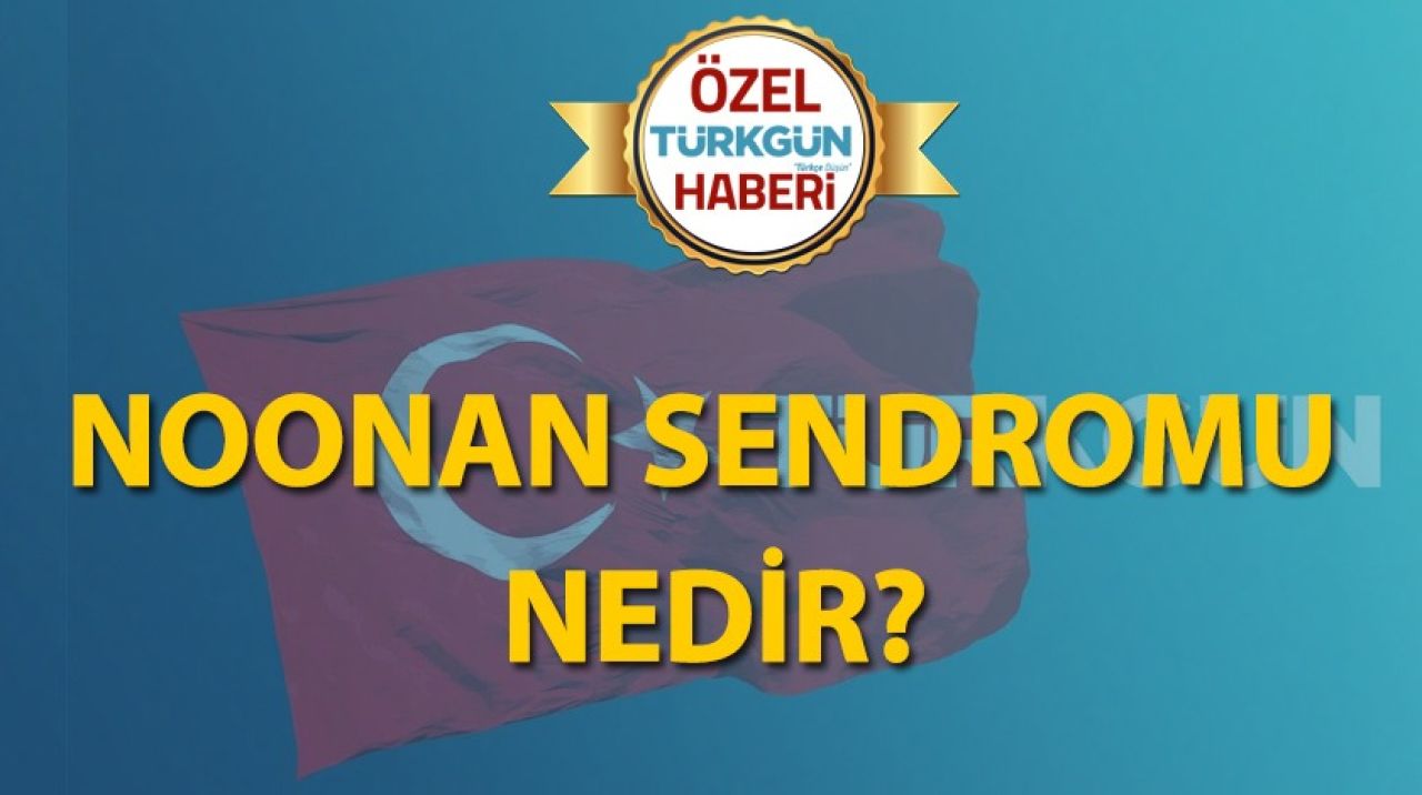 Noonan sendromu nedir?