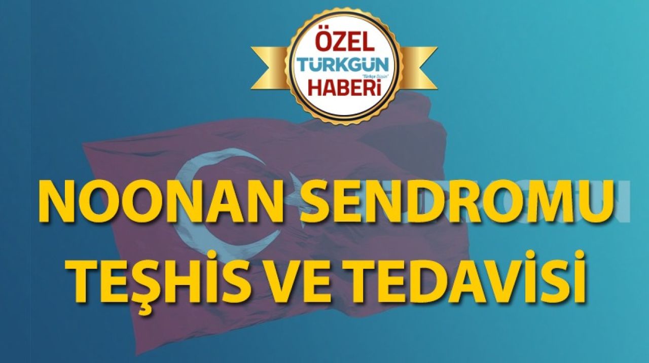 Noonan sendromu teşhis ve tedavisi