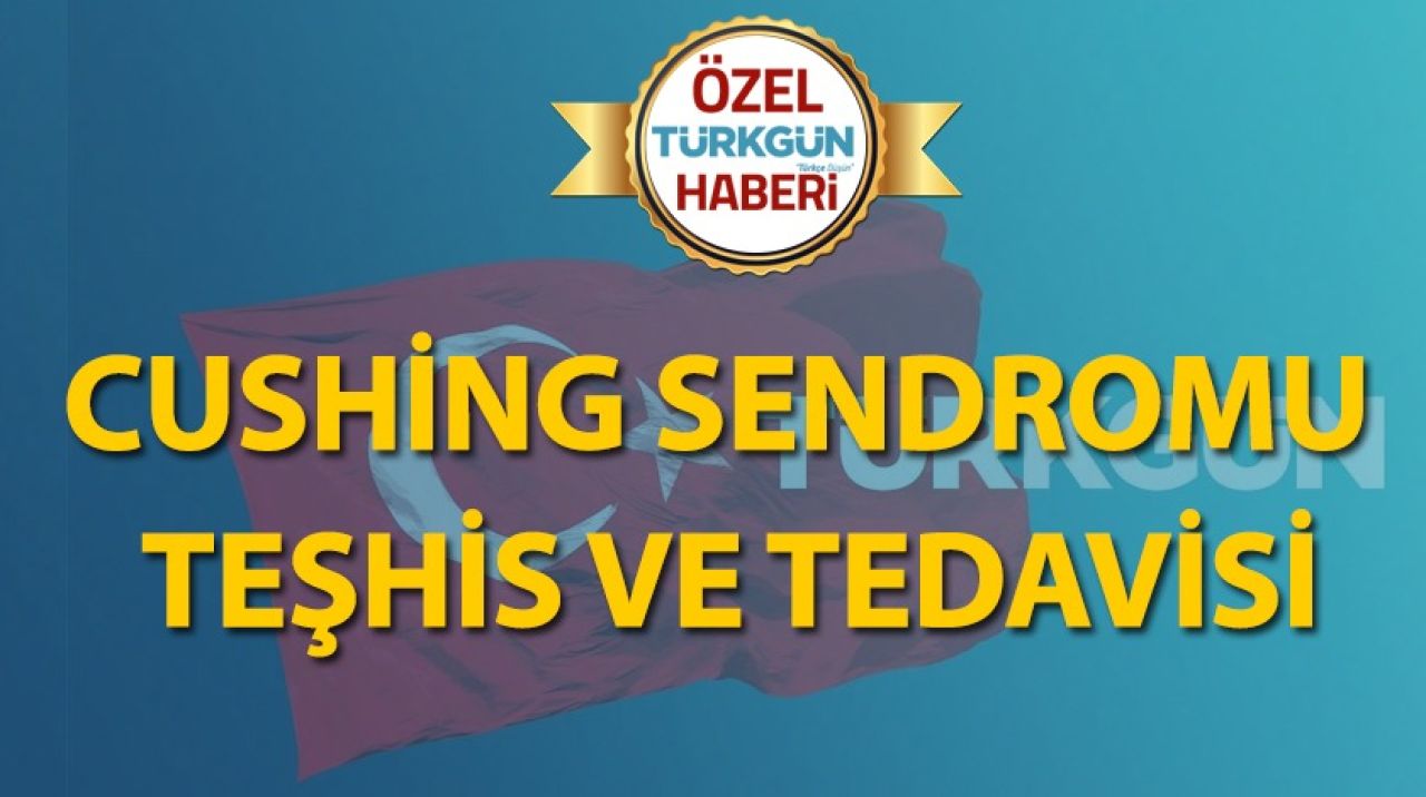 Cushing sendromu teşhis ve tedavisi