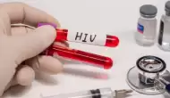 HIV Nedir ve Nasıl Bulaşır? Ölümcül mü?