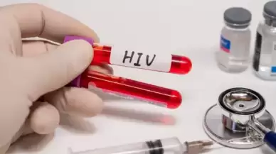 HIV Nedir ve Nasıl Bulaşır? Ölümcül mü?