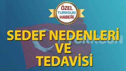 Sedef nedenleri ve tedavisi