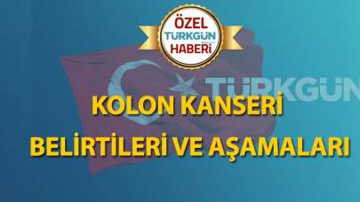 Kolon kanseri belirtileri ve aşamaları