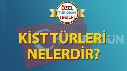 Kist türleri nelerdir?