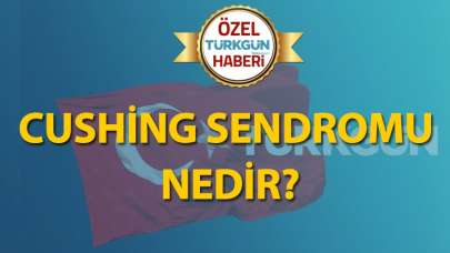 Cushing sendromu nedir?