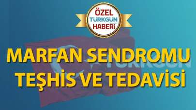 Marfan sendromu teşhis ve tedavisi