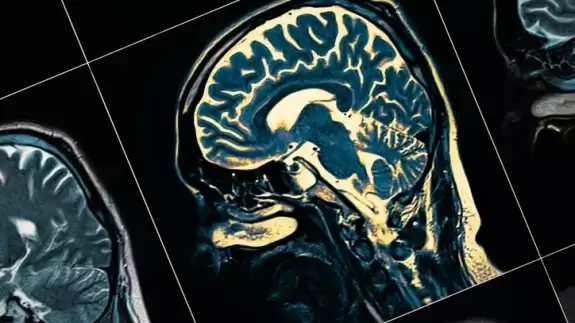 Bu meyveyi yiyenin beyni hiç yaşlanmıyor! Ne Alzheimer riski kalıyor ne de Parkinson