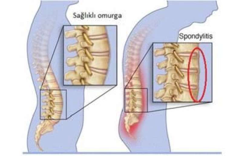 Buna dikkat etmezseniz boyunuz kısalabilir! 13