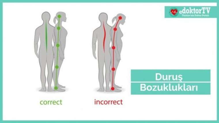 Buna dikkat etmezseniz boyunuz kısalabilir! 7