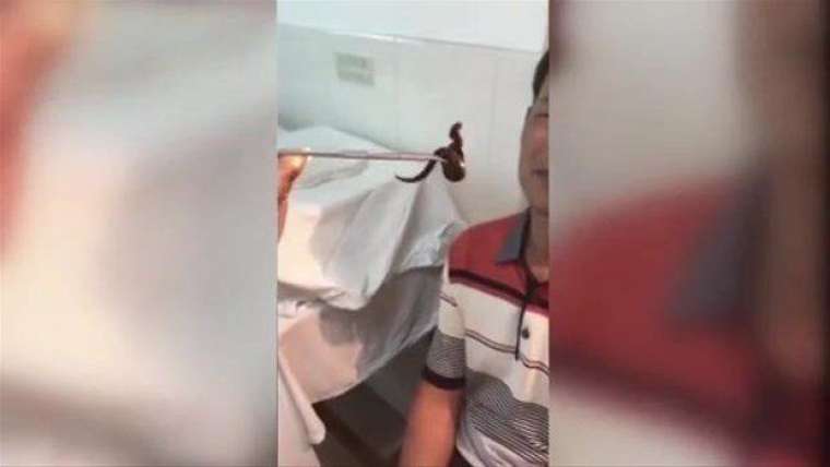 Kulağından çıkanı görünce doktor bile şaşırdı! 17