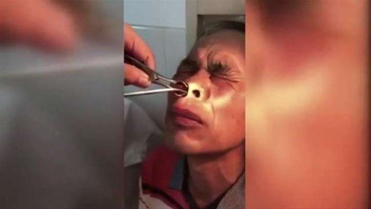 Kulağından çıkanı görünce doktor bile şaşırdı! 13