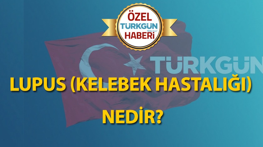 Lupus (Kelebek hastalığı) nedir?