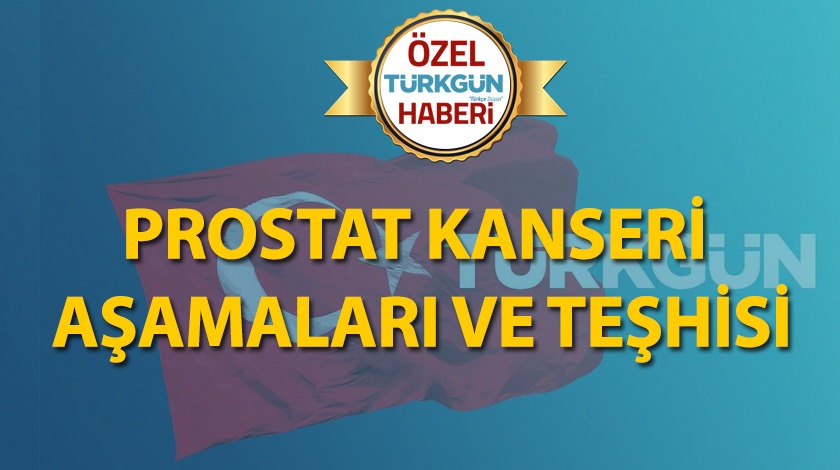 Prostat kanseri aşamaları ve teşhisi