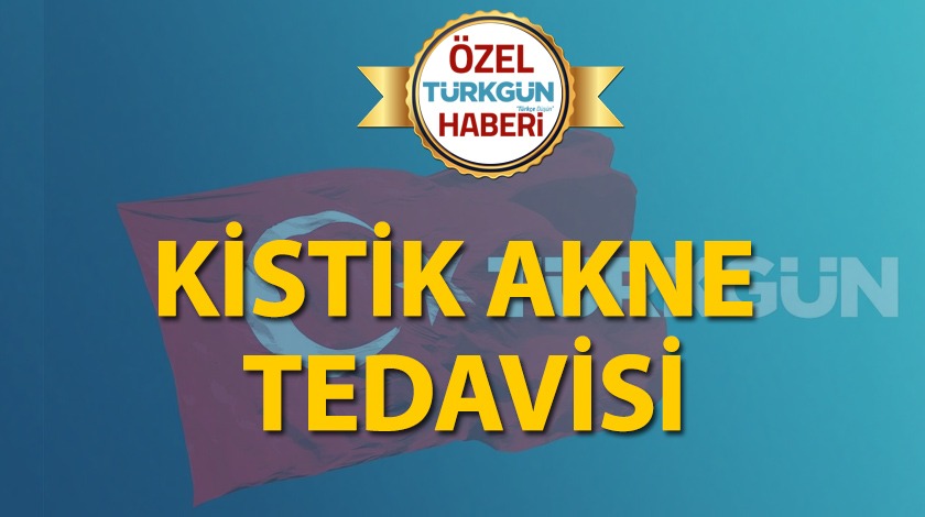 Kistik akne tedavisi