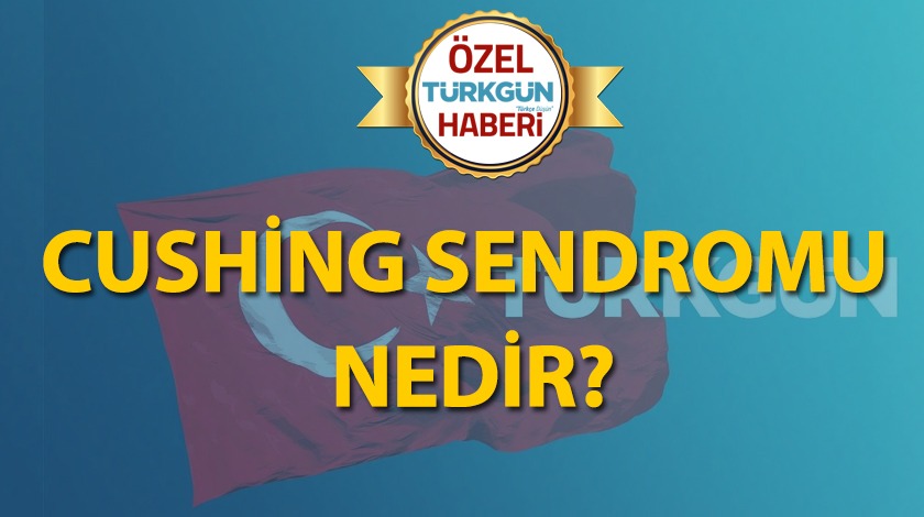 Cushing sendromu nedir?