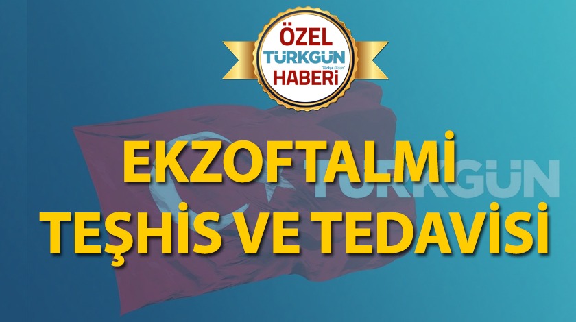 Ekzoftalmi teşhis ve tedavisi