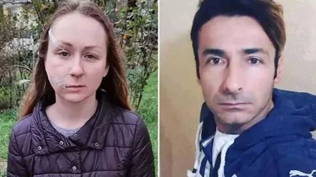 Ukraynalı eşinin yüzünü falçatayla kesen sanığa tahliye
